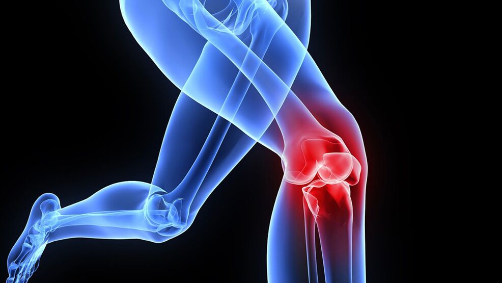 Προβλήματα στο γόνατο λόγω οστεοαρθρίτιδας